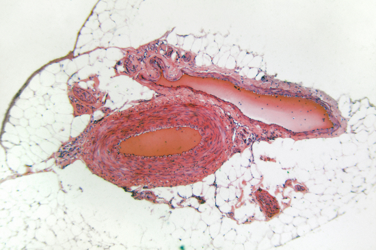 Coupe microscopique d'une artère (à gauche) et d'une veine
